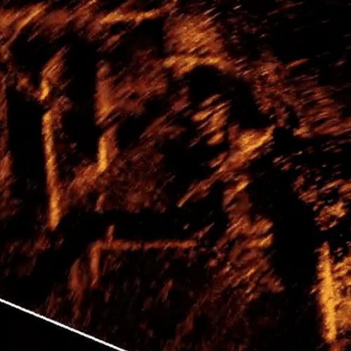 Датчик ActiveTarget™ Live Sonar